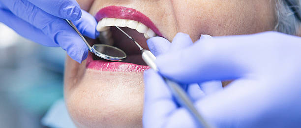 Best Emergency Root Canal Treatment in Brookfield, WI